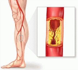 inferior tehnica Doppler a membrelor (finale) membrele inferioare tehnica Doppler