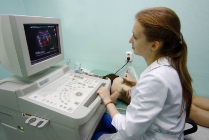 Vasculare Doppler (ultrasonografie) - scanare duplex vasculară (duplex) Doppler vasculară (ecografie) - recipiente de scanare duplex