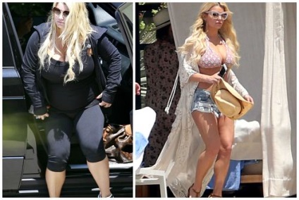 Jessica Simpson, înainte și după fotografii și video de chirurgie plastică (Jessica) Jessica Simpson, înainte și după fotografii și video de chirurgie plastica