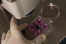 Fertilizarea in vitro (FIV) (Assisted Reproductive Technology) Fertilizarea in vitro (FIV)