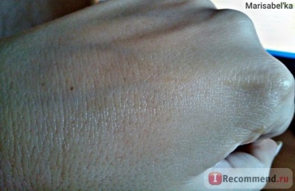 gel resorbabil pentru argot mamavit san - „chisturi mamare in mamavit gel absorbabil sân (gel) gel resorbabil pentru argotic mamavit san - „chisturi mamare în mamavit gel absorbabil de san
