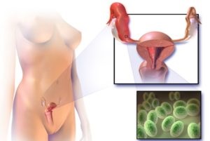 Tratamentul verucilor genitale, cauze si fotografii (papilomavirus uman) veruci genitale tratament, cauze si imagini