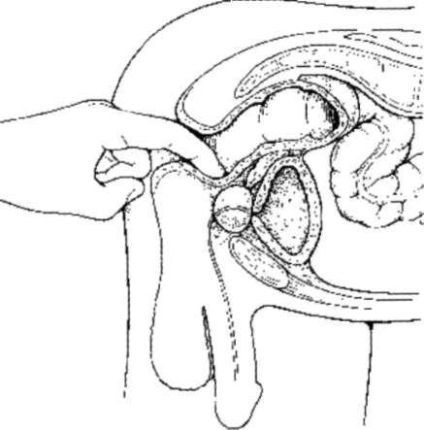 Capitolul 4 Diagnosticul bolilor urologice (urologie) Capitolul 4 Diagnosticul bolilor urologice