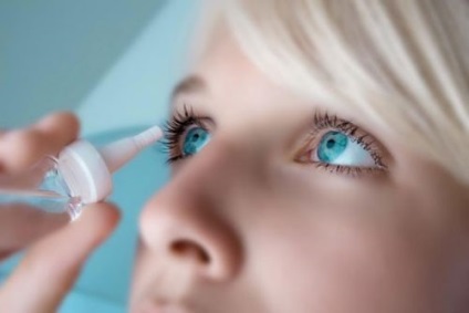 Eyedrops alergie (alergie de picături pentru ochi) Picături pentru ochi împotriva alergiilor