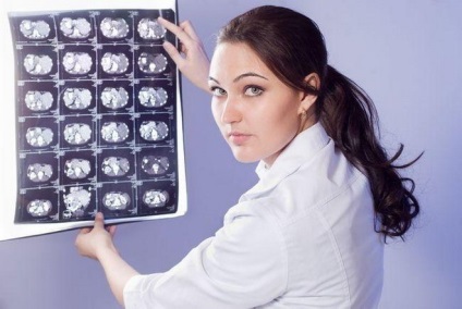 Chist în special după un tratament de accident vascular cerebral si de prevenire (tratament) Chist în special după un tratament de accident vascular cerebral si de prevenire