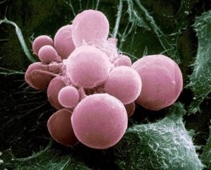 Un chist în vezica biliară la un copil, simptome, tratament de remedii populare și chirurgie (fiere) Un chist în vezica biliară la un copil, simptome, tratament de remedii populare și chirurgie