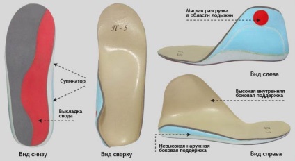 Pe osul piciorului provoaca aparitia, tratamente, prevenire (cauza) Piatra pe piciorul cauzelor, de metode de tratament, prevenire