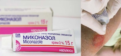 Unguent priveze un agent eficient persoană (e) Unguent de la privarea unei persoane un mijloc eficient