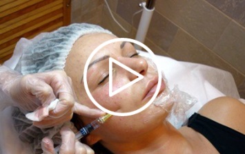Melanoformny nevus clasificare, caracteristici, factori de risc, tratament (factorii) Melanoformny nevus clasificare, caracteristici, factori de risc, tratament