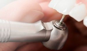 Pornirea dinților sub coroana dacă se pisa sub durere metaloceramicele (durere) Transformarea dinților pentru coroane dacă se pisa rănit un cermet