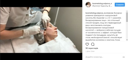 Caracteristici ale biorevitalisation (necesită consultanță de specialitate) Caracteristici ale biorevitalisation