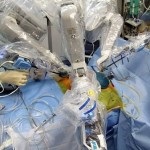 Transplantul de pancreas in raspunsurile de diabet (transplant) Transplantul de pancreas in comentarii diabet