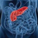 Transplantul de pancreas in raspunsurile de diabet (pancreatic) Transplantul de pancreas in comentarii diabet
