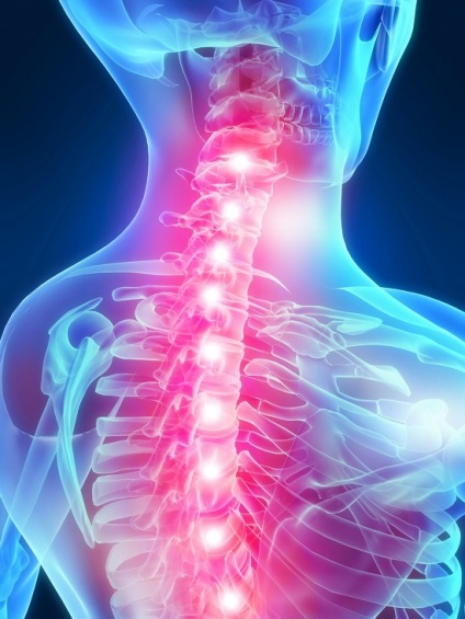Simptomele subluxație vertebră, semne, diagnostic și tratament (tratament) simptome subluxație vertebră, semne, diagnostic și tratament