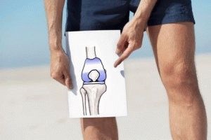 simptomele artritei posttraumatice si tratament (simptome) simptomele artritei posttraumatice și tratament