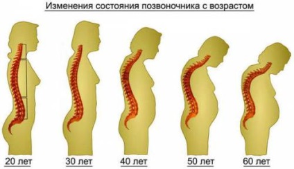 Cotorul structurii umane (schema), coloanei vertebrale și funcțiile