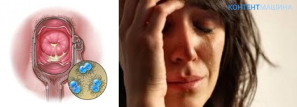 Simptomele de gonoree in simptomele si tratamentul femeilor (semne) Simptomele gonoreei la femei simptome și tratament