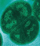 Radioresistance - l (organismele) Radioresistance - l