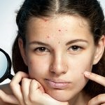 Iritarea roseata pielii, tratament peeling și cauza (a pielii) Iritarea înroșirea pielii, peeling tratament si cauze