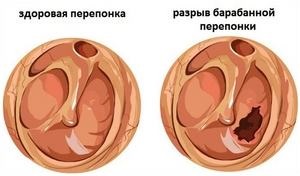 Timpan cum ar fi tratate manifestate (tratate) Timpanului ca un manifest și tratat
