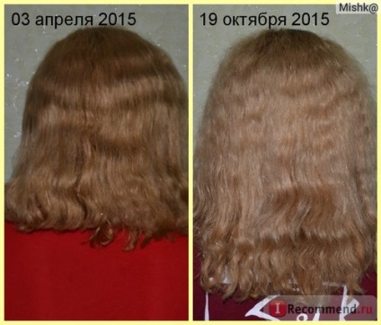 Sare - „creștere sălbatică a părului și a unghiilor (de creștere) Sare - „creștere sălbatică a părului și unghiilor