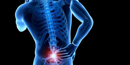 coloanei vertebrale Spondylarthrosis ce este, cum de a vindeca, droguri, exerciții fizice (spondiloartrita) coloanei vertebrale Spondylarthrosis ce este, cum de a vindeca, de droguri, exercitarea