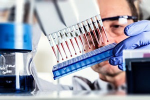 Tipuri de cancer pulmonar - cum sa se verifica pentru simptome (auto) Tipuri de cancer pulmonar - cum sa se verifice simptomele