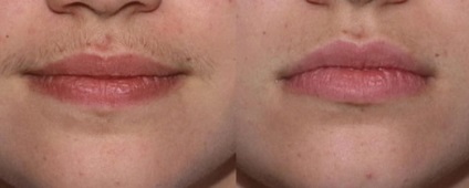 Voskovoya epilat ceara buza de sus a alege și de a face pașii (ceara pentru îndepărtarea părului de pe fata) Voskovoya epilat ceara buza de sus a alege și de a face pașii