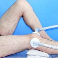 Recuperarea dintr-o fractură încheietura mâinii - bisturiu - informații medicale și educație (după) Recuperarea dintr-o fractură încheietura mâinii - bisturiu - informații medicale și educație