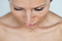peeling chimic al feței (facial) Peelingul facial chimice