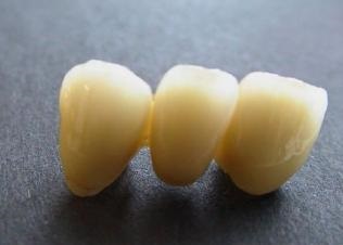 Ceramica estetica, siguranta, biocompatibilitate (fiabilitate) Ceramica estetica, fiabilitate și biocompatibilitate