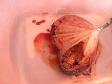 Durere sub marginea din stânga se poate obține dureri de rău sub marginea din stânga din față și din spate (stânga) Durere sub marginea din stânga se poate obține dureri de rău sub partea din față stânga și marginea posterioară