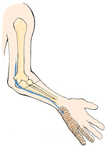 Durere în mâna dreaptă (încheietură, palma, degete) »spine❺ (încheietura mâinii) Durere în mâna dreaptă (încheietură, palma, degete) »spine❺