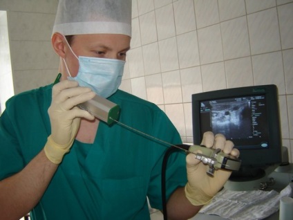 nod uter fibromatoase in tratament, diagnostic (tratament) nod fibromatoase in tratarea uterului, diagnostic