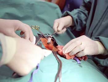 Pancreatita hemoragică cauze, simptome, tratament si prognostic (tratament) Pancreatita hemoragică cauze, simptome, tratament și prognostic