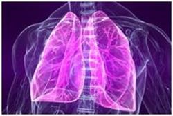 șoc cardiogen (durata acestei condiții de severitate) șoc cardiogen