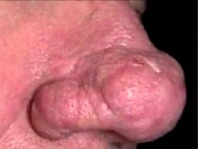 Rozaceea este ceea ce este, imagine (rozacee) Rozaceea este ceea ce este, fotografii