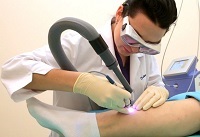 Îndepărtarea cu laser a venelor la nivelul picioarelor sau scleroterapii (vasculare) Îndepărtarea cu laser a venelor de pe picioare sau scleroterapii