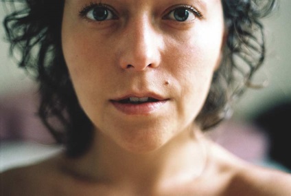 Acidul hialuronic la nivelul pielii (acid hialuronic, mecanismul de acțiune) Acidul hialuronic la nivelul pielii