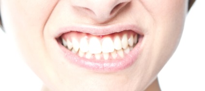 Hipertrofică gingivite etiologie, forme, tratament (gingivite hipertrofică diagnostic diferențial) Hipertrofică gingivite etiologie, forma, tratament