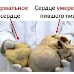 Cum sa faci un stil de viață sănătos inima sanatoasa (sanatoasa) Cum de a face inima stil de viață sănătos sănătos
