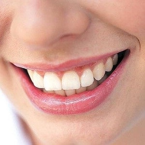 Cum să aibă grijă de gingiilor (de ingrijire) Cum să aibă grijă de gingiilor