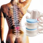Tratamentul uterin adenomioza Duphaston (uter) Tratamentul uterin adenomioza djufaston