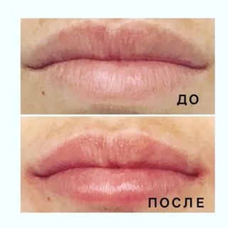 clinica mea (@my_clinic_yalta) - instaliga este cel mai bun Instagram web-telespectatorul (_______________________________________________________ Ialta Yalta yaltagram) clinica mea (@my_clinic_yalta) - instaliga este cel mai bun Instagram web-vizualizator