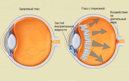 instrucțiuni de utilizare taurina, picături pentru ochi, ochi, picături de utilizare () instrucțiuni de utilizare taurina, picături pentru ochi, ochi, utilizarea de