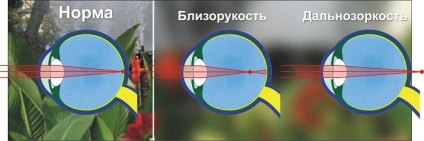 instrucțiuni de utilizare taurina, picături pentru ochi, ochi, utilizarea (ochi) instrucțiuni de utilizare taurina, picături pentru ochi, ochi, utilizarea de