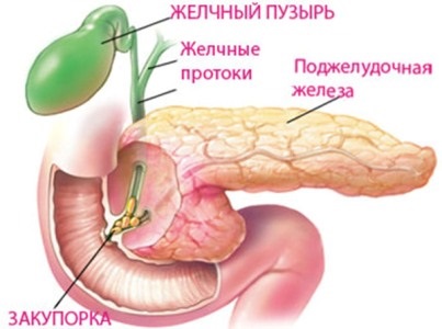 Dieta pentru stagnarea bilei în vezica biliară alimentare de sănătate, meniuri, rețete