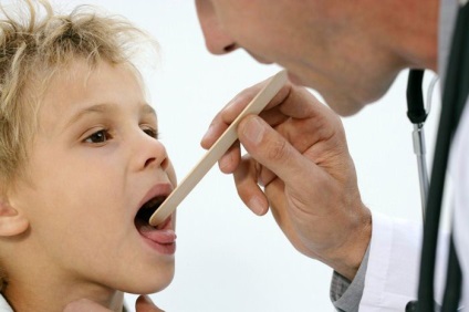 Metode de tratament și profilaxie a speciilor fungice la boala gât