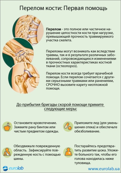 Нарушаването на заздравяването на костни фрактури - травматология - Медицински Енциклопедия