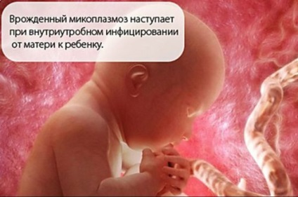 Симптомите на уретрит симптоми и диагностициране на заболяване